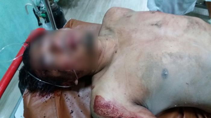 Gerebek Judi Jackpot 2 Anggota Polisi di Massa 1 Sekarat, 1 Mobil Sedan Rusak