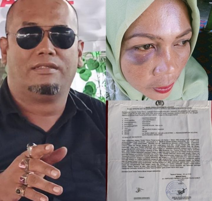 Saat Hadiri Pesta, Sahrina Harahap di keroyok beberapa orang di Paluta,