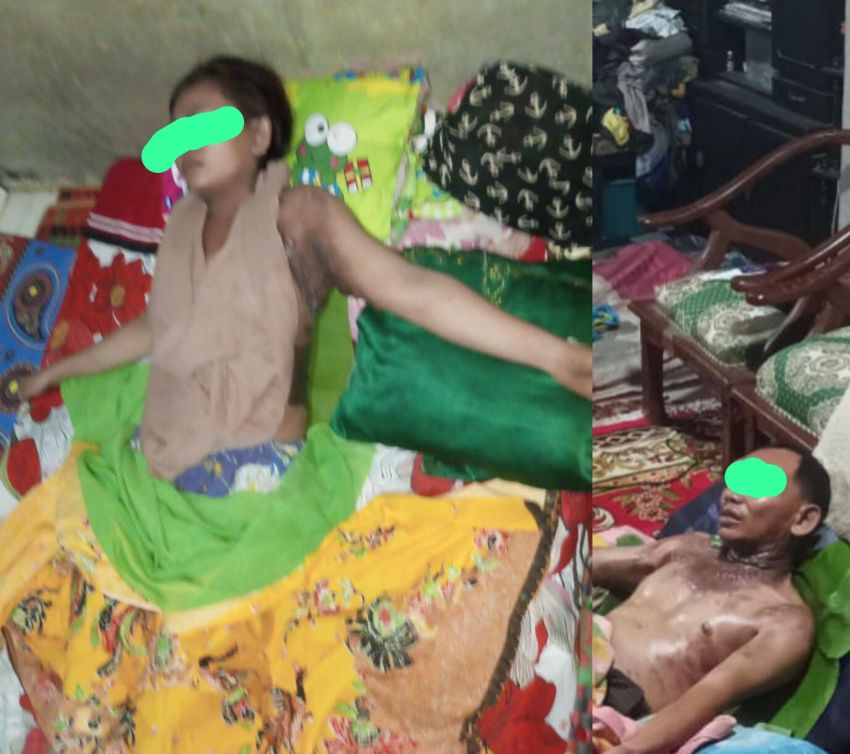 Tragis! Simpan Bara Emosi, Oknum Sekdes Bakar Teman Wanita Sendiri di Padangsidimpuan.