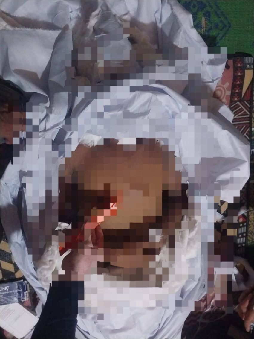 Lagi, Tawuran di Belawan Pecah, 1 Orang Tewas Terkena Busur Anak Panah