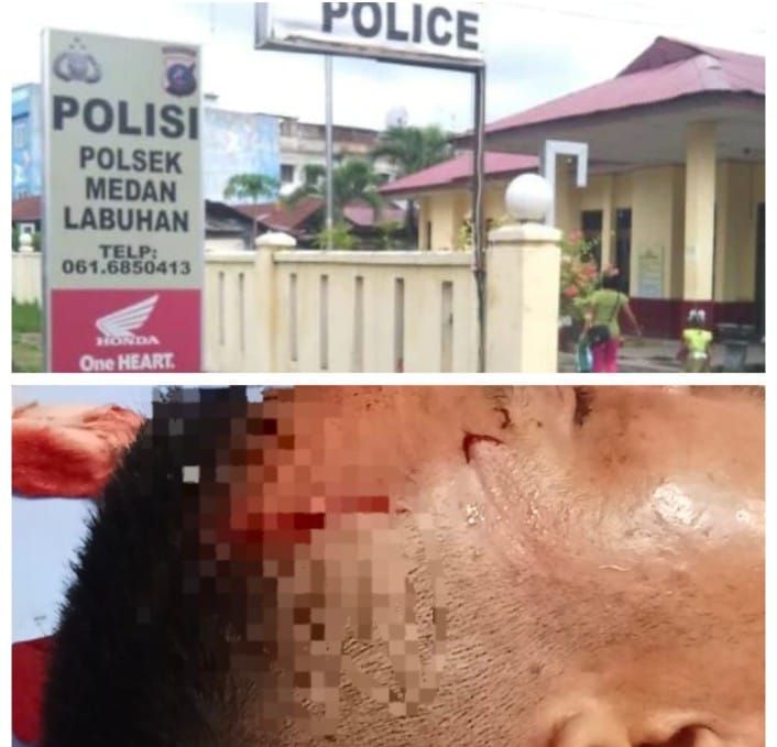 Setahun, Polsek Medan Labuhan Diduga Endapkan Kasus Pembacokan